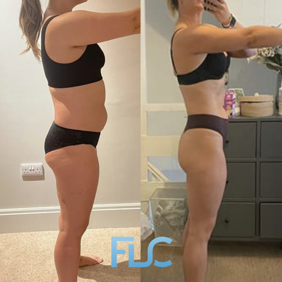 Charlotte before and after transformation