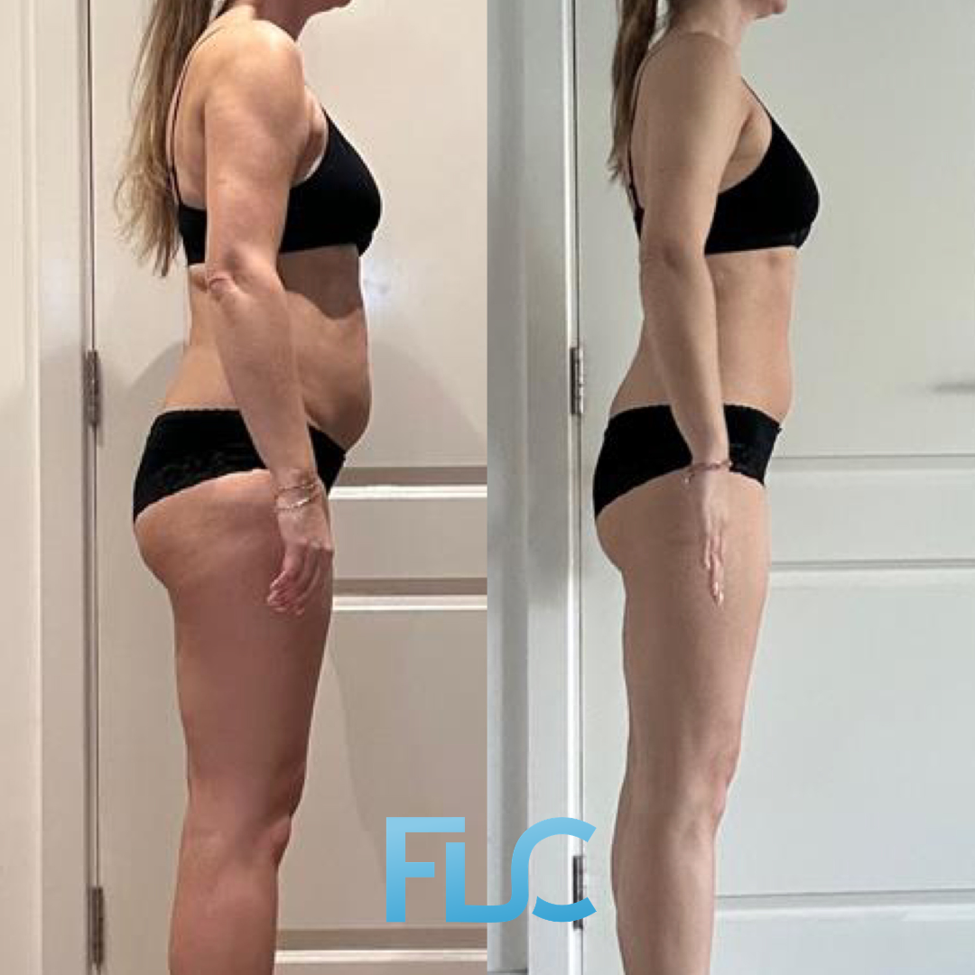 Lucy before and after transformation